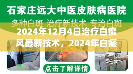 2024年白癜風(fēng)治療最新技術(shù)解讀與應(yīng)用前景展望，革新與未來(lái)趨勢(shì)