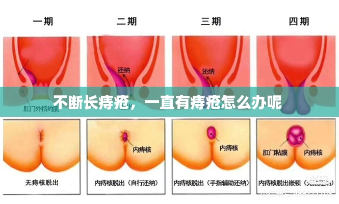 不斷長痔瘡，一直有痔瘡怎么辦呢 